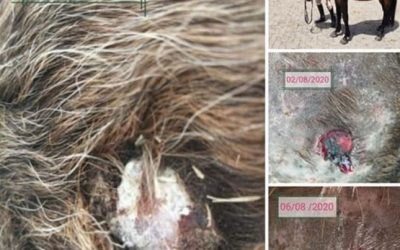 Sarcoid Treatment from Surgery to Thermal Mud